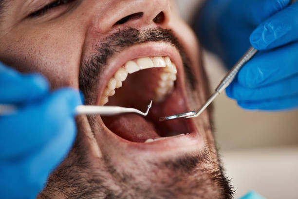 Emergency Dental Services in South Houston, TX